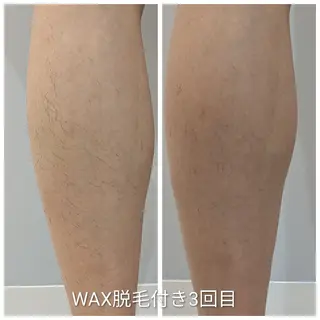 もりの木 整骨院＆整体院のエステ・リラクイメージ