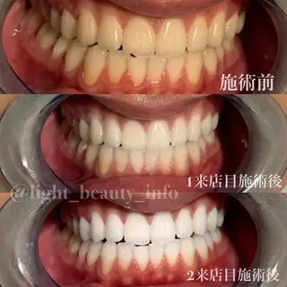 ライトビューティー 銀座店のエステ・リラクイメージ