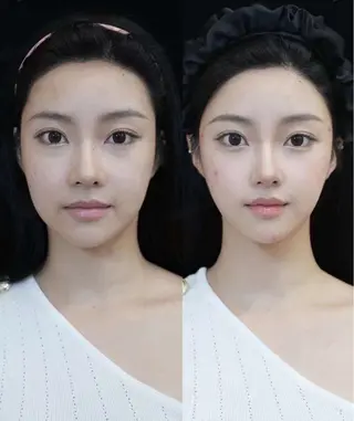 マツエク・マツパ 愛維美水光美肌専門店所属・愛維美水光美肌専門店 メンズレディースokのエステ・リラクイメージ