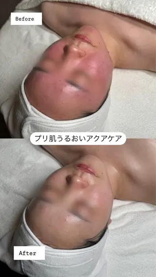 韓国肌管理🫧LDM 🫧Junnaのエステ・リラクイメージ