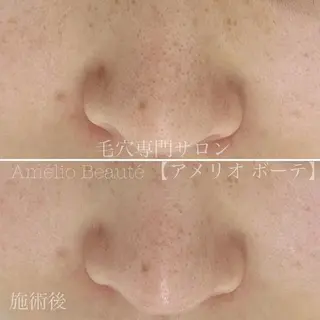 毛穴ケア専門サロン Amélio Beauté所属・毛穴ケア専門サロン アメリオボーテのその他イメージ