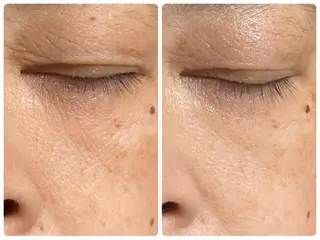 ナリス化粧品De I’mあべのルシアス所属・山本 紗織のエステ・リラクイメージ