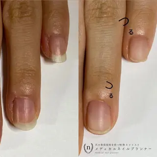 ネイル tsuki elfのエステ・リラクイメージ