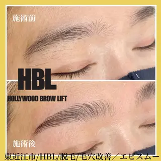 アイブロウ epismoo 脱毛/HBL/毛穴の眉毛・アイブロウイメージ