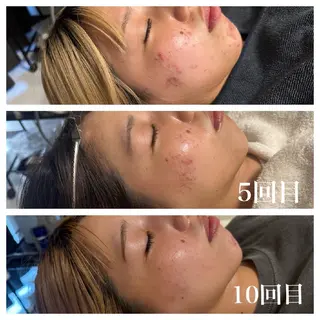 肌質改善Beauty salon Renのエステ・リラクイメージ