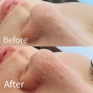 メンズ アンベリー 北浜店のエステ・リラクイメージ