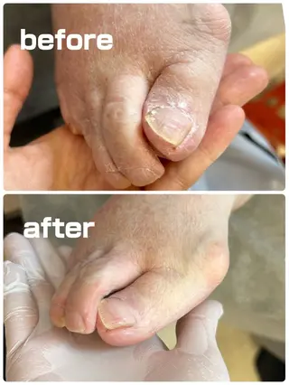 巻き爪フットケアサロンKotori所属・フットケアサロン Kotoriのその他イメージ