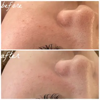 メンズ メナード岐阜市茜部 杉浦のエステ・リラクイメージ