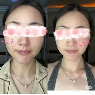 ネイル aliaハイフ&水光ジェットサロン所属・aliaハーブ水光店 エステティシャン募集のエステ・リラクイメージ