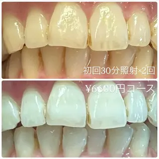 PLATINUM Beauty 横浜店所属・ホワイトニングルーム 横浜店のその他イメージ