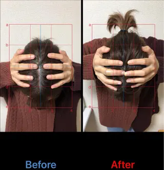 やはた鍼灸整骨院所属・やはた 鍼灸整骨院のエステ・リラクイメージ