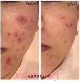 Vary まなみのエステ・リラクイメージ