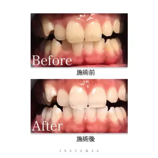 鍼灸整骨院Refine所属・鍼灸 Refineのその他イメージ