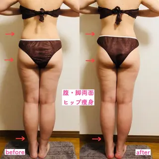 Lunon 【ルノン】のエステ・リラクイメージ