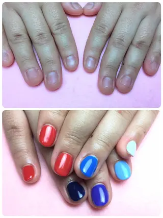 ネイル 深爪矯正/爪育成ケア manie nailのネイルデザイン