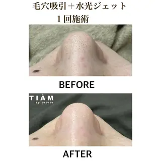 美肌サロンTIAM by tetoteのエステ・リラクイメージ