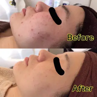 vary  clue MISAのエステ・リラクイメージ