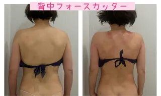 ブライダル痩身×脱毛 尼崎駅前サロンのエステ・リラクイメージ