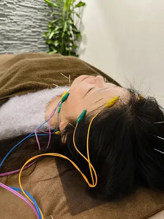 美容鍼灸整体サロンBeauJu所属・小顔矯/美容鍼/鍼灸 BeauJuのその他イメージ