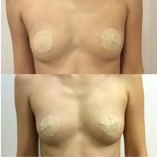 ROSALIA 【バストアップ、痩身、毛穴洗浄】所属・ROSALIA バスト 小顔 毛穴のエステ・リラクイメージ