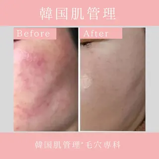 韓国肌管理 【毛穴専科】のエステ・リラクイメージ