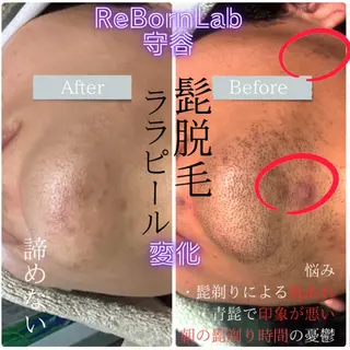 メンズ ReBorn  Lab所属・リボーン ラボのエステ・リラクイメージ