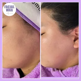 facial salon Lily所属・salon Lilyのエステ・リラクイメージ