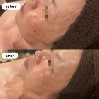 &LINO YUMIのエステ・リラクイメージ