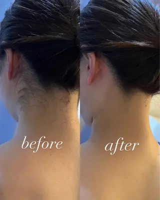 うなじ脱毛/美肌脱毛 LABELのエステ・リラクイメージ