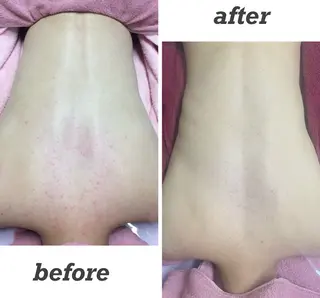 韓国美肌/肌質改善 【天神】yuiのエステ・リラクイメージ