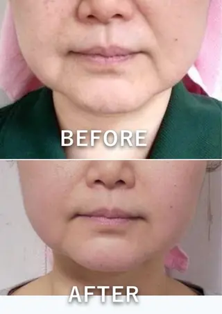 脂肪冷却/美肌改善 COCOKARAのエステ・リラクイメージ