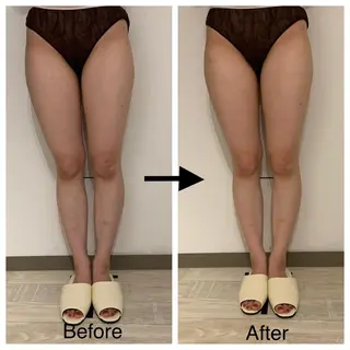 リンパマッサージ&ピラティスmimoza所属・リンパマッサージ mimozaのエステ・リラクイメージ