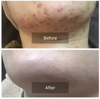 マツエク・マツパ ハーブピーリング専門 🌿モッカのエステ・リラクイメージ