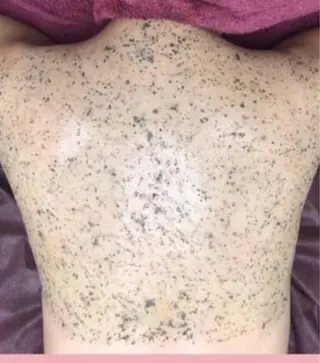 ☺ハーブピール💕 ソフィアカロン💖のエステ・リラクイメージ