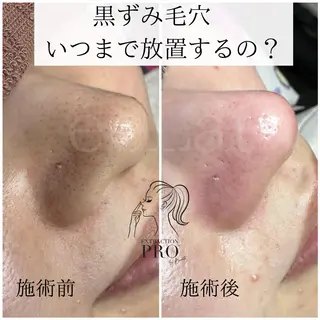 岩本 麻那のマツエク・マツパデザイン