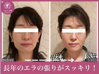 盛れる小顔矯正師 たく先生のエステ・リラクイメージ