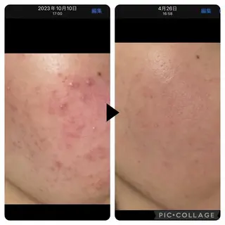 溝の口エステranan所属・化粧品成分研究/講師 ranan三浦のエステ・リラクイメージ