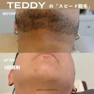 メンズ TEDDY BASE 眉＆脱毛サロンのエステ・リラクイメージ