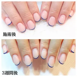 ネイル Viseo《6週間 長持ちパラジェル》のネイルデザイン