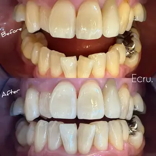 メンズ キッズ ホワイトニングサロン Ecru所属・ホワイトニングサロン Ecru エクリュのその他イメージ