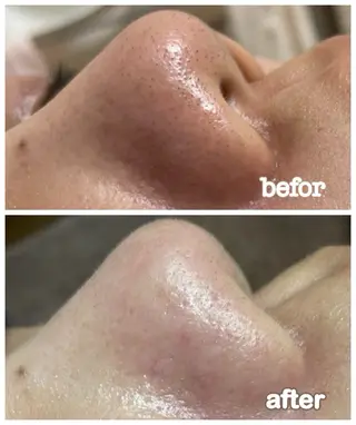 エステルーム　ラティア所属・今井 登美子のエステ・リラクイメージ