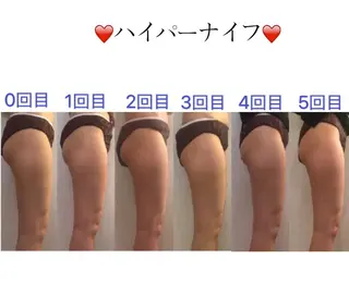 OPREA 栄店のエステ・リラクイメージ