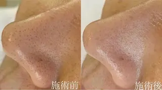 ハーブピーリング専門 muro.のエステ・リラクイメージ