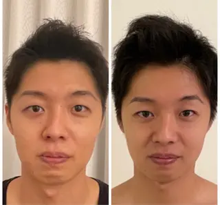 小顔コルギ＆オイル アンドエスのエステ・リラクイメージ