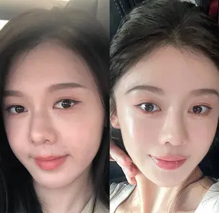 ネイル aliaハイフ&水光ジェットサロン所属・aliaハーブ水光店 エステティシャン募集のエステ・リラクイメージ