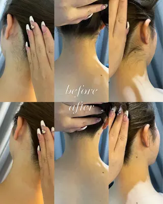 うなじ脱毛/美肌脱毛 LABELのエステ・リラクイメージ