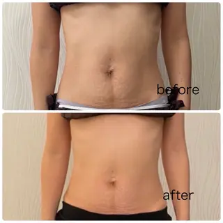 次世代痩身 人生最後のダイエットのエステ・リラクイメージ