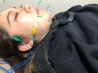 やはた鍼灸整骨院所属・やはた 鍼灸整骨院のエステ・リラクイメージ