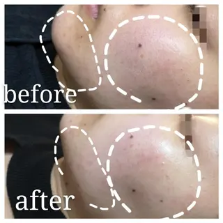 🅖🅤🅩🅔🅛 salonのエステ・リラクイメージ