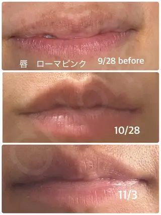 川越ローマピンク 光脱毛＆ワックス脱毛のエステ・リラクイメージ